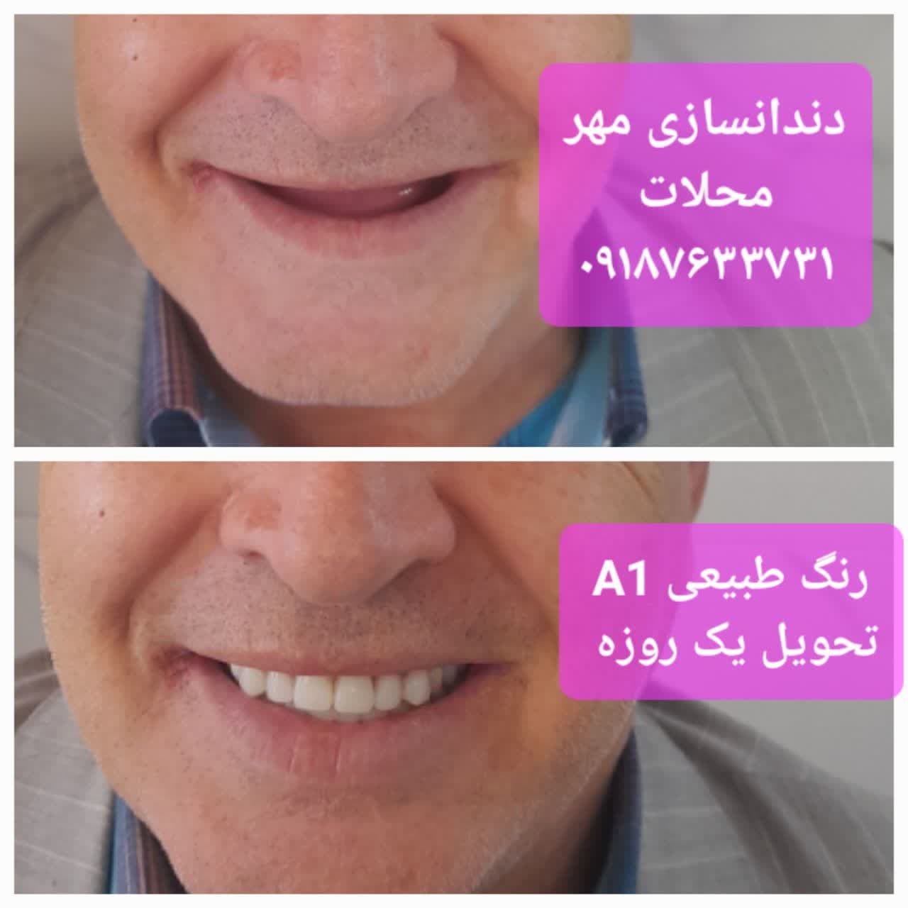 دندانسازی مهر محلات