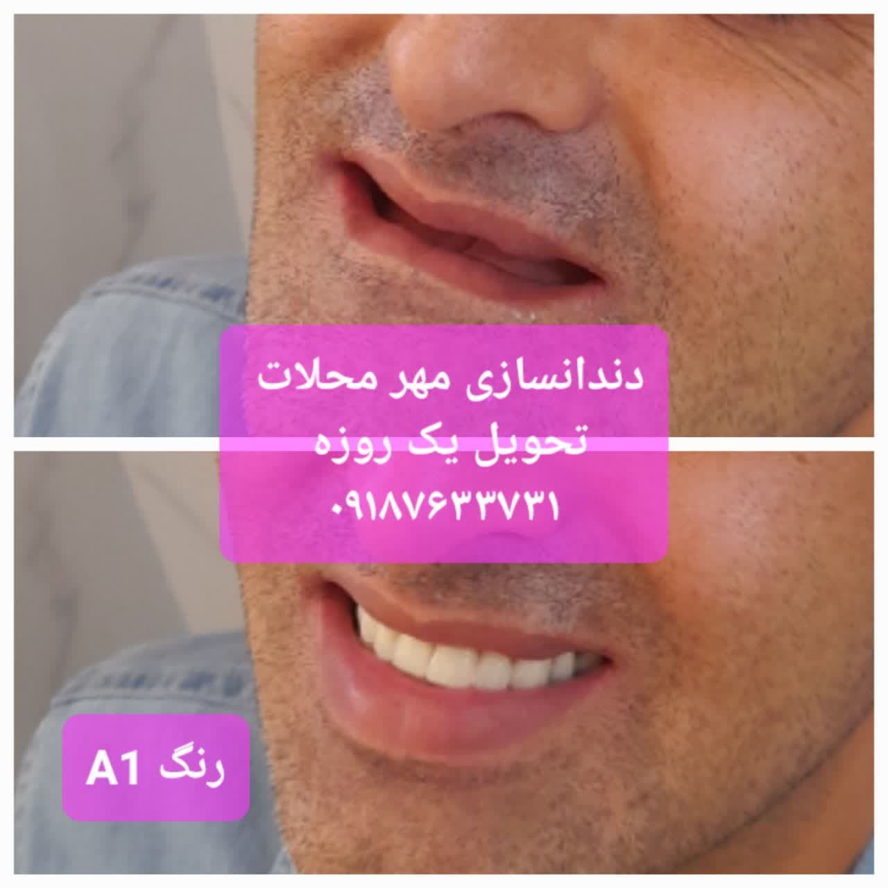 دندانسازی مهر محلات