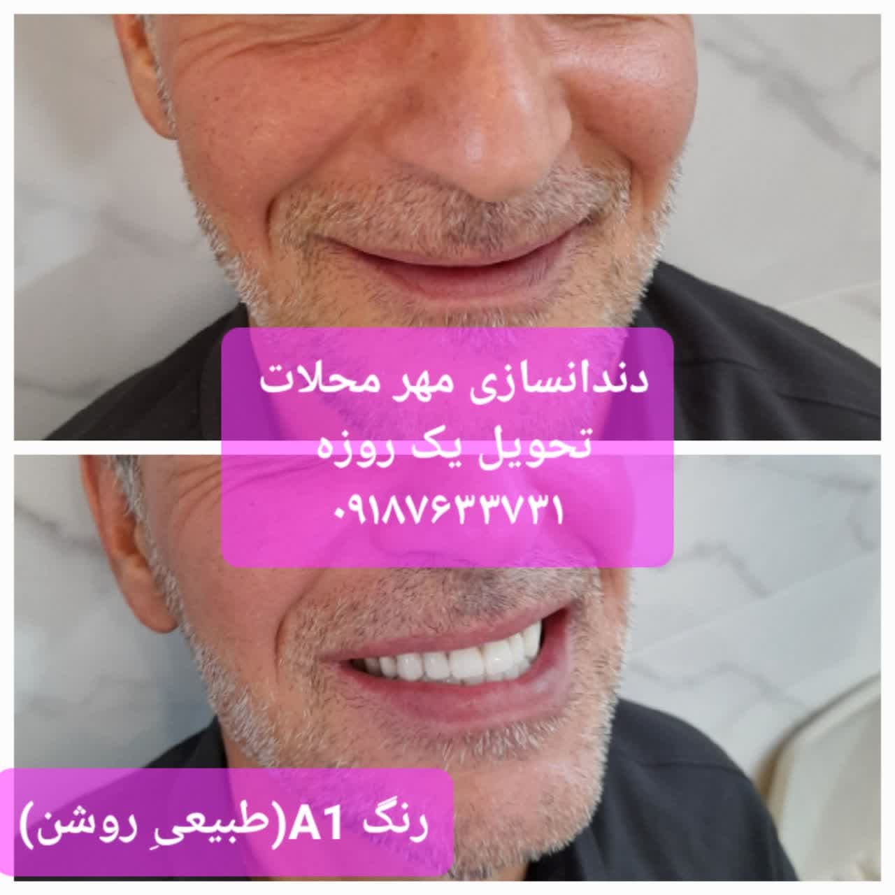 دندان سازی مهر محلات