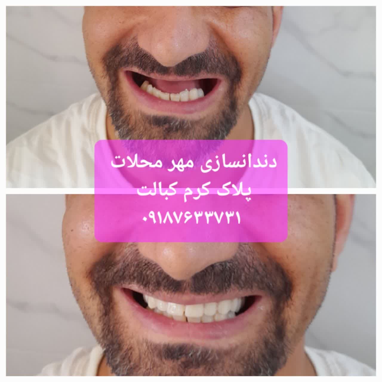 پلاک کرم کبالت محلات