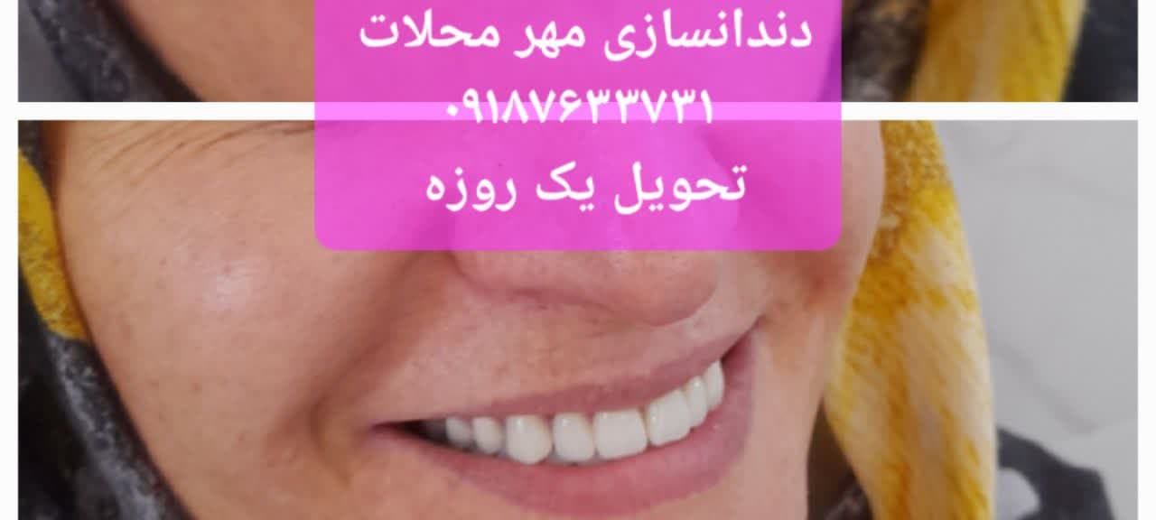 دندانسازی مهر محلات