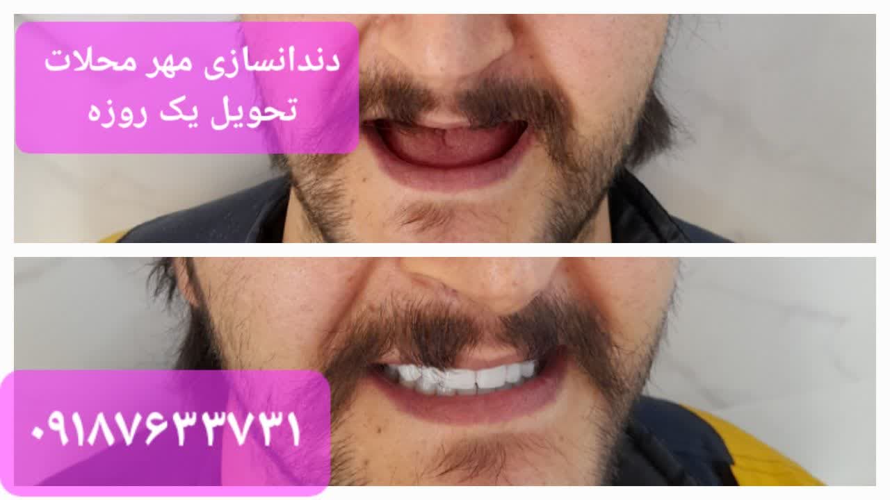 دندانسازی مهر محلات